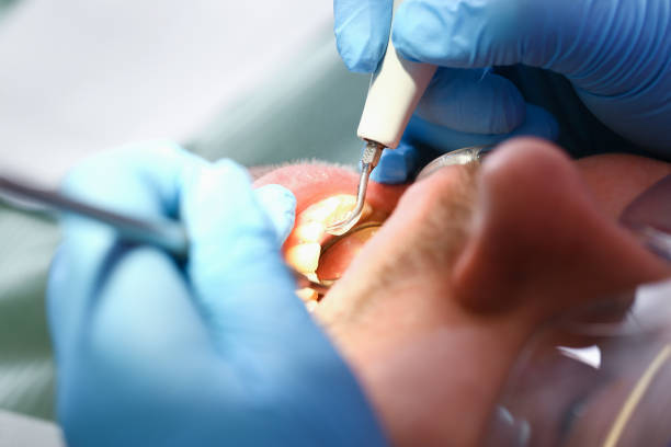 Best Tooth Infection Emergency Dentist  in Monmouth Junction, NJ
