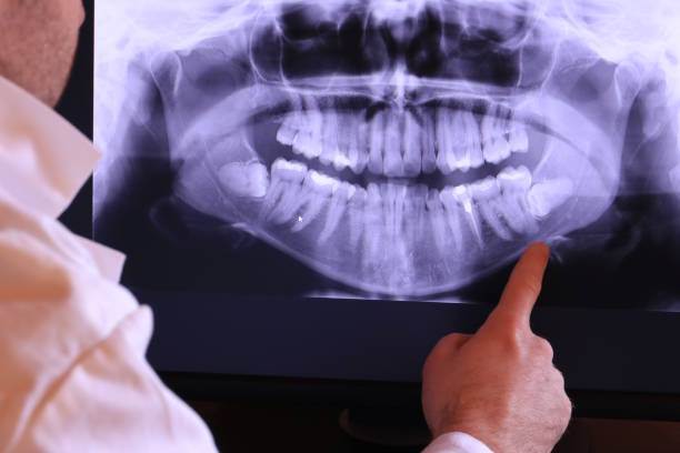 Best Tooth Pain Emergency Relief  in Monmouth Junction, NJ