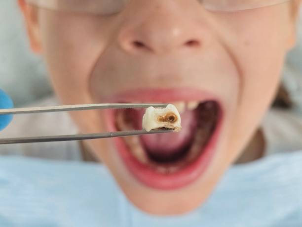 Best Broken Tooth Emergency  in Monmouth Junction, NJ